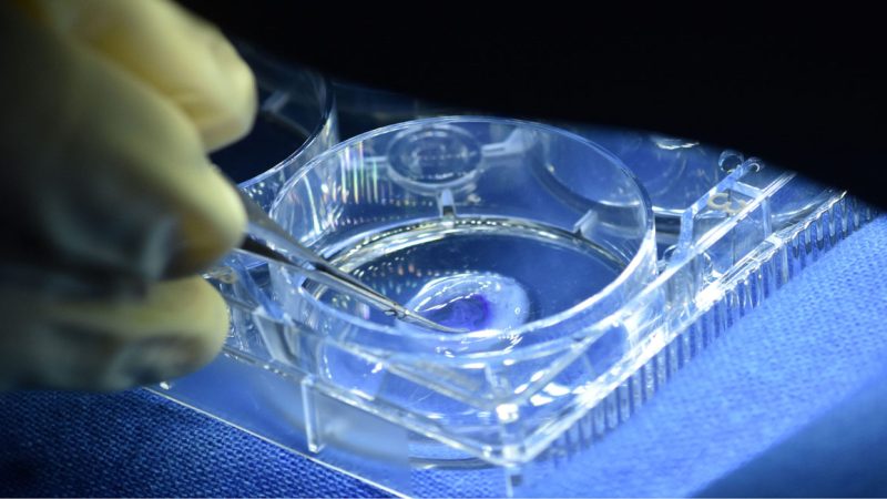Hyderabad scientists achieve lasting cornea repair using stem cells