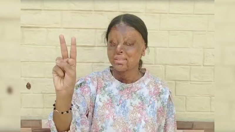 Chandigarh Teen Lost Eyes In Acid Attack, Scores 95.6% In Class 12 Boards