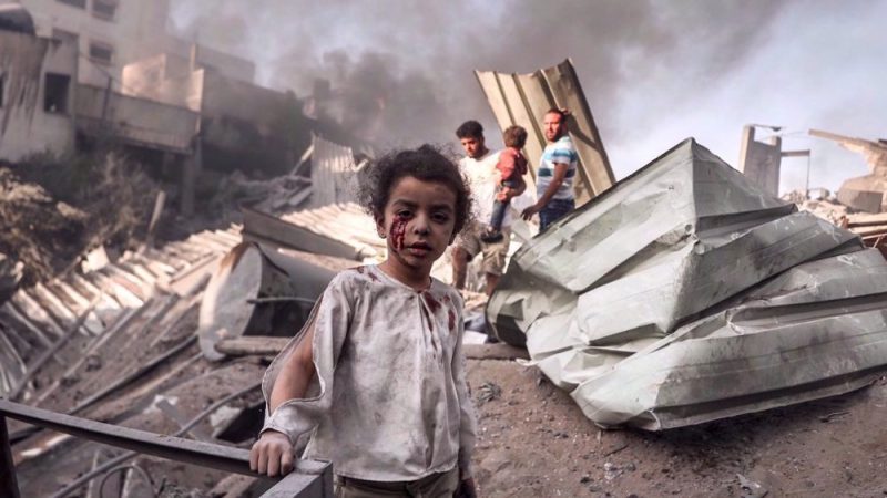 ‘Political wounds’: UK denies Gaza children medical treatment