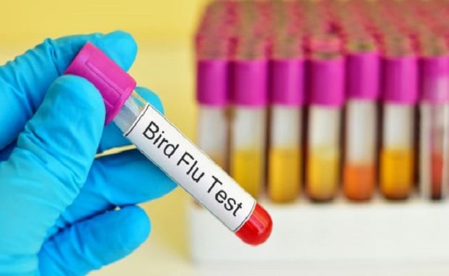 What is H5N1 Virus? How It Spreads to Humans