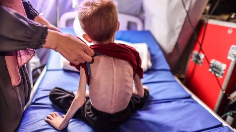 Gaza child, 4, dies from severe malnutrition due to Israeli blockade