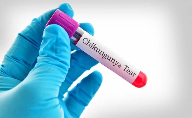 Chikungunya On Rise In Maharashtra: Follow These Tips For Fast Recovery