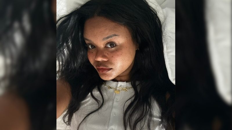 US Woman Tells How Rare Allergic Reaction From Acne Drug Nearly Killed Her