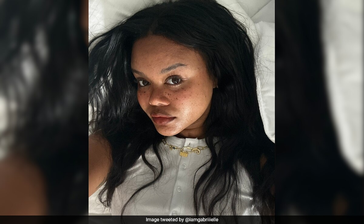 US Woman Tells How Rare Allergic Reaction From Acne Drug Nearly Killed Her