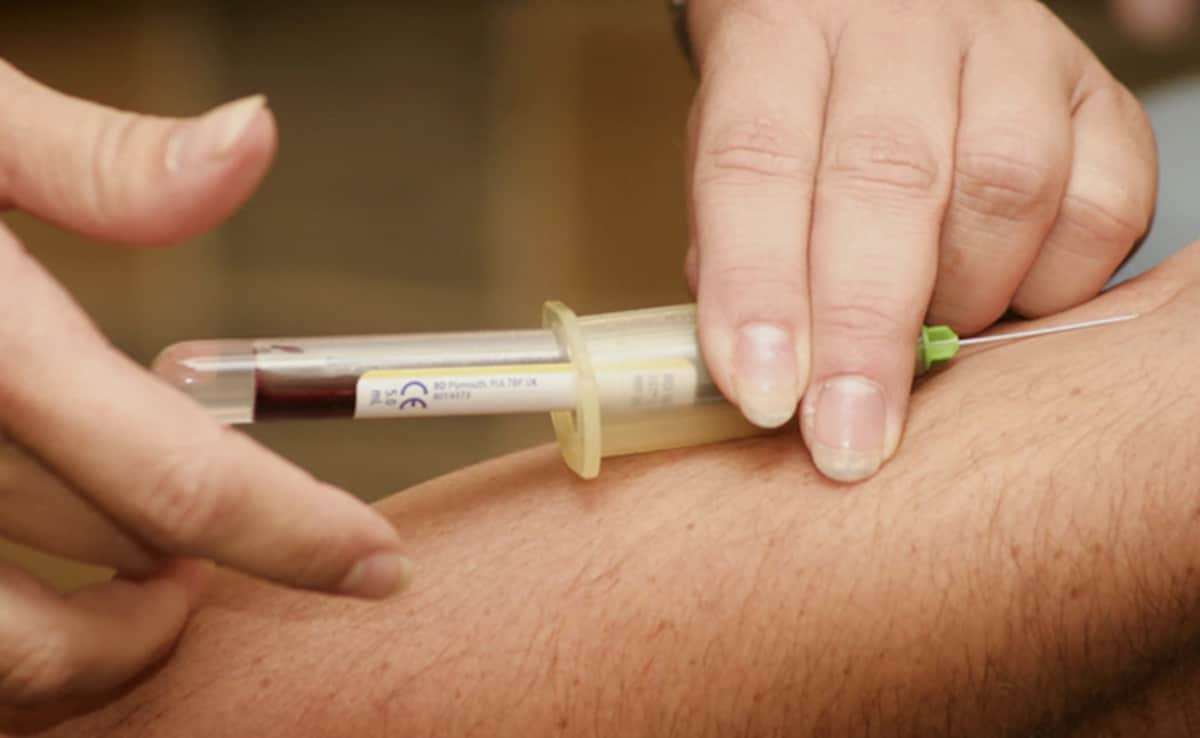 In A First, Alzheimer's Blood Test Available in US From June