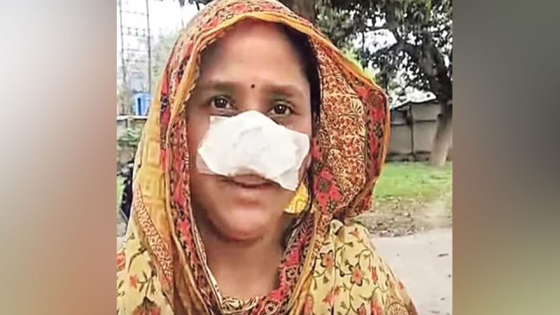 Husband bites off wife’s nose in shocking attack